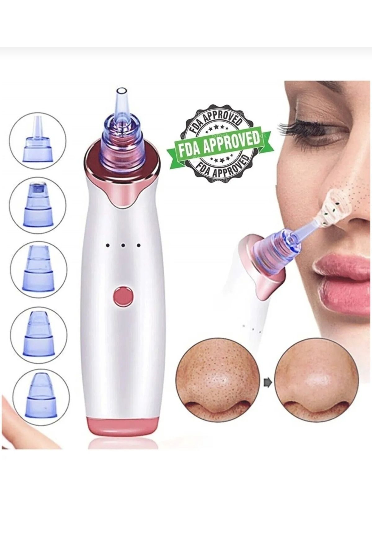 Şarjlı Derma Suction 40 Kpa Vakumlu Siyah Nokta Ve Yüz Temizleme Cihazı (ALETİ)