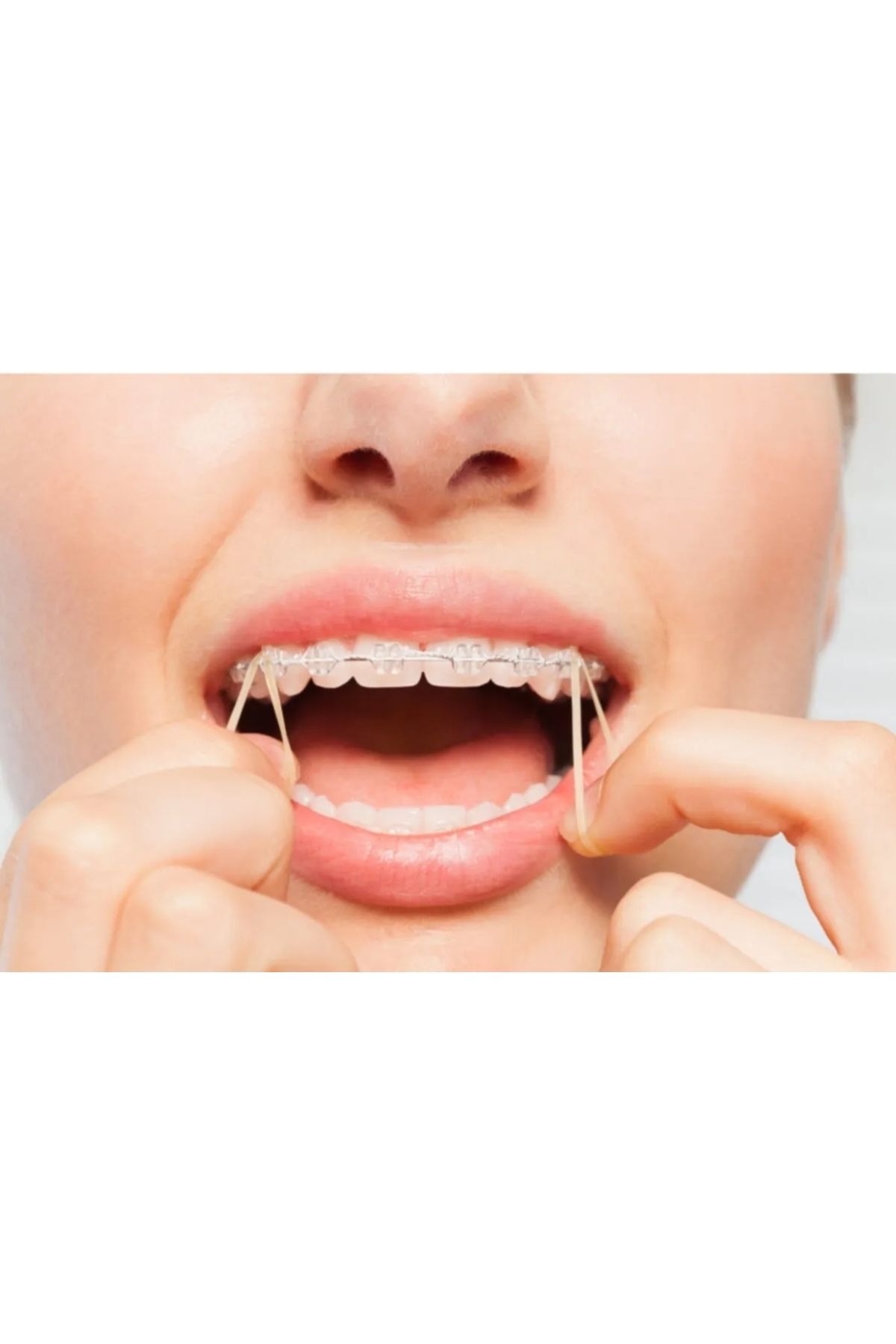 dehaberk Ağıziçi Ortodontik Elastik Rondel 3/16 Medium