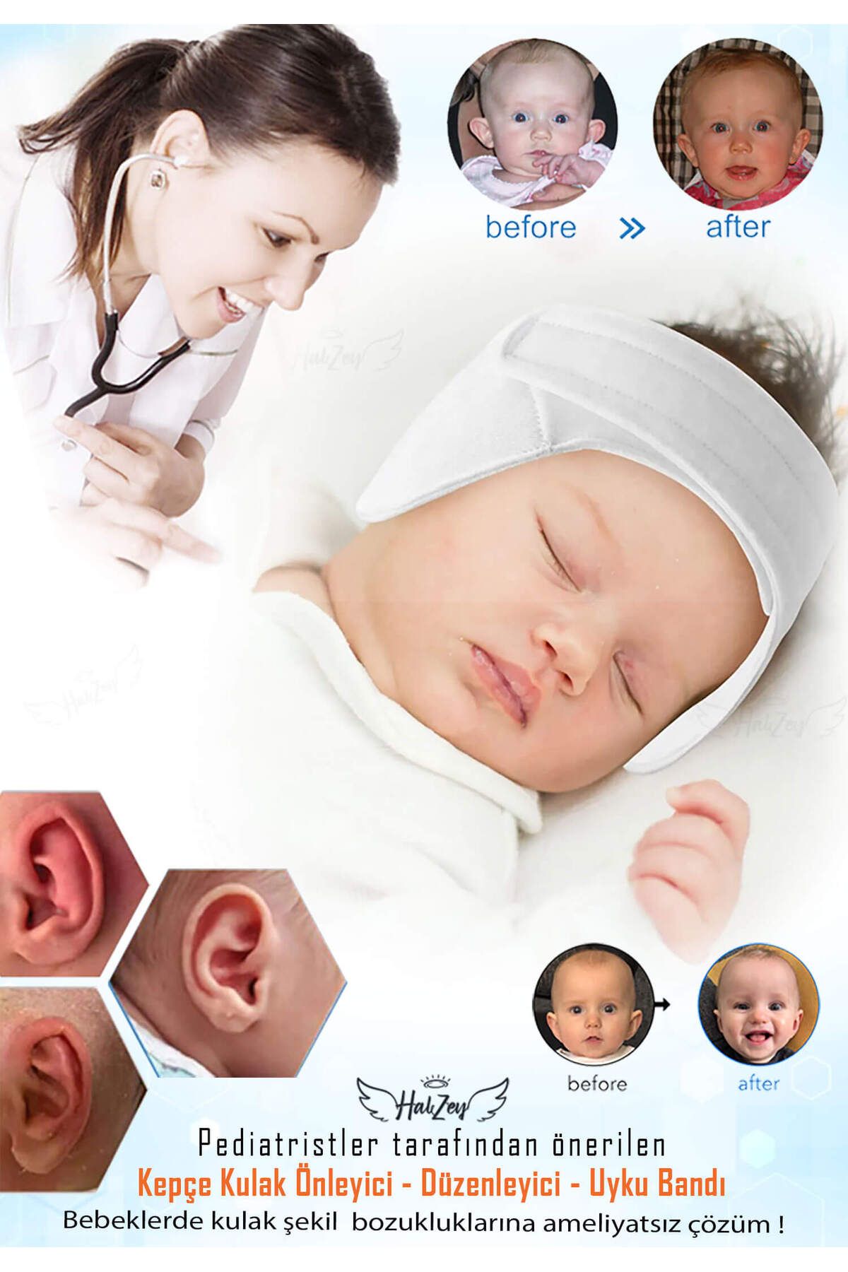 HALZEY Bebek Kepçe Kulak Bandı / Kepçe Kulak Önleyici Ayarlanabilir Cırtları sayesinde 0- 2 Yaş arası uygun