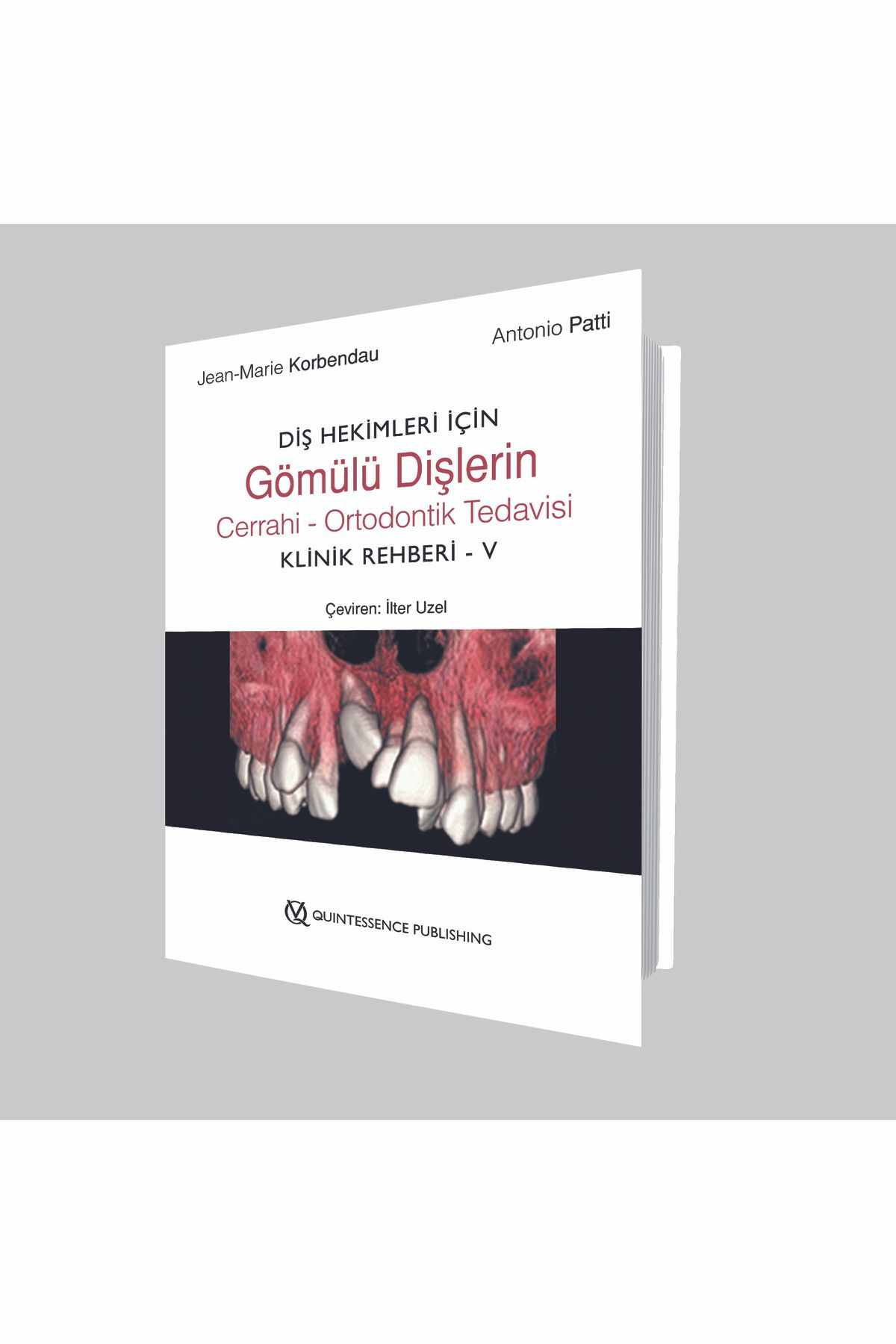 Quintessence Yayıncılık Diş Hekimleri Için Gömülü Dişlerin Cerrahi - Ortodontik Tedavisi Klinik Rehberi - V