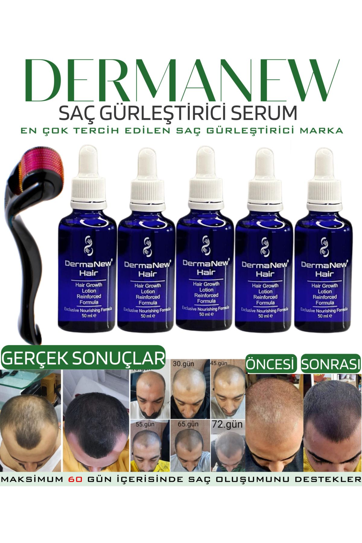 dermanew hair Dermanewhair Saç Gürleştirici Losyon Saç Losyonu - Dermanew - Sac Sıkarıcı / 5 Adet Serum Roller