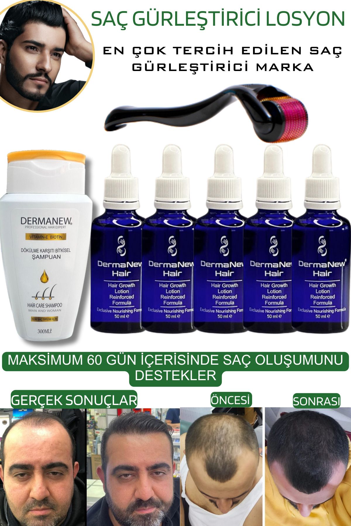 dermanew hair Saç Serum Roller Mavi Şampuan Hediyeli / /5x50ml