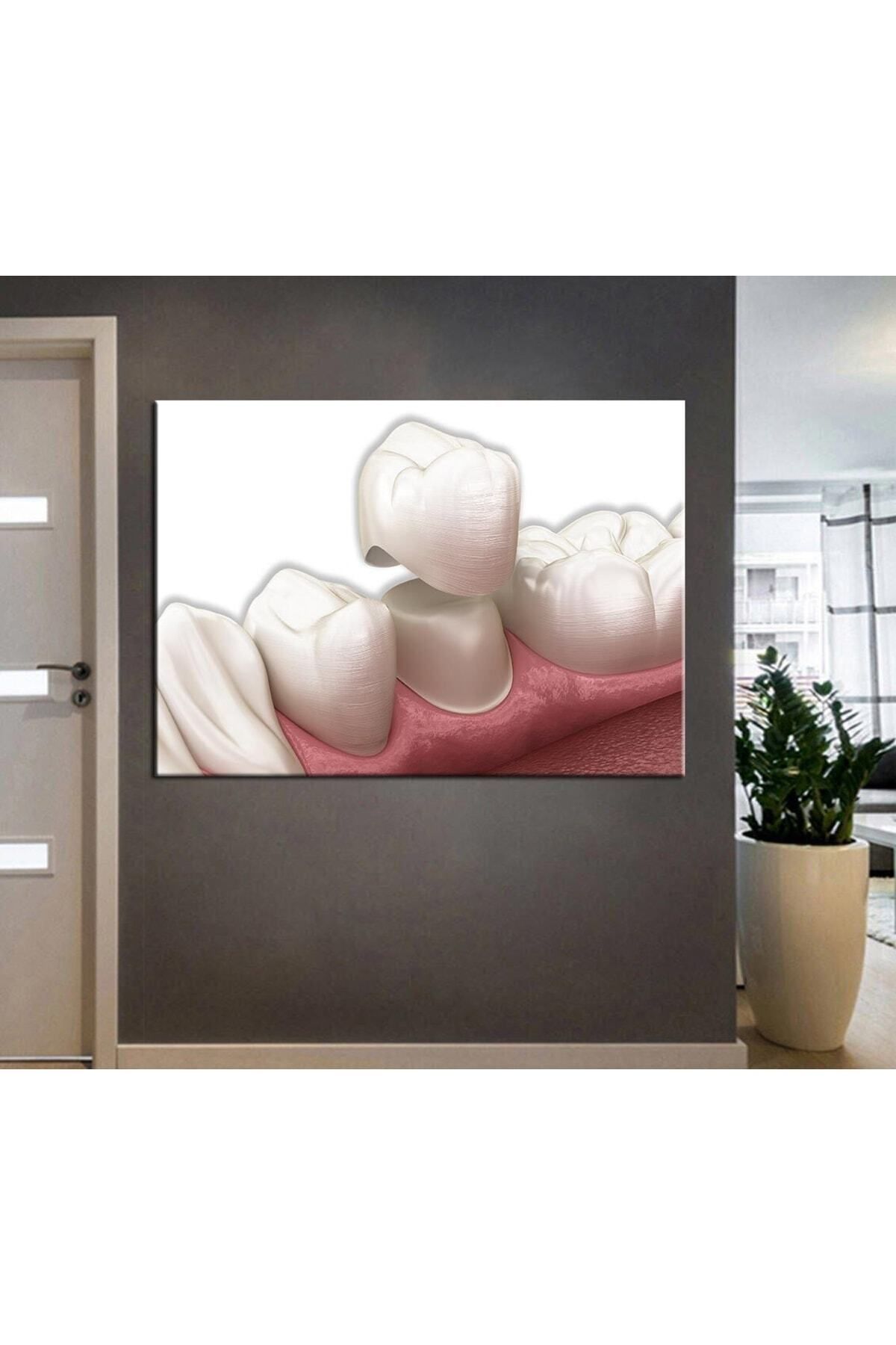 Piri Kanvas Tablo Ağız Ve Diş Sağlığı Polikliniği tabloları Dekoratif Diş, Dekoratif Dişçi, Dişçi Dekorasyonu