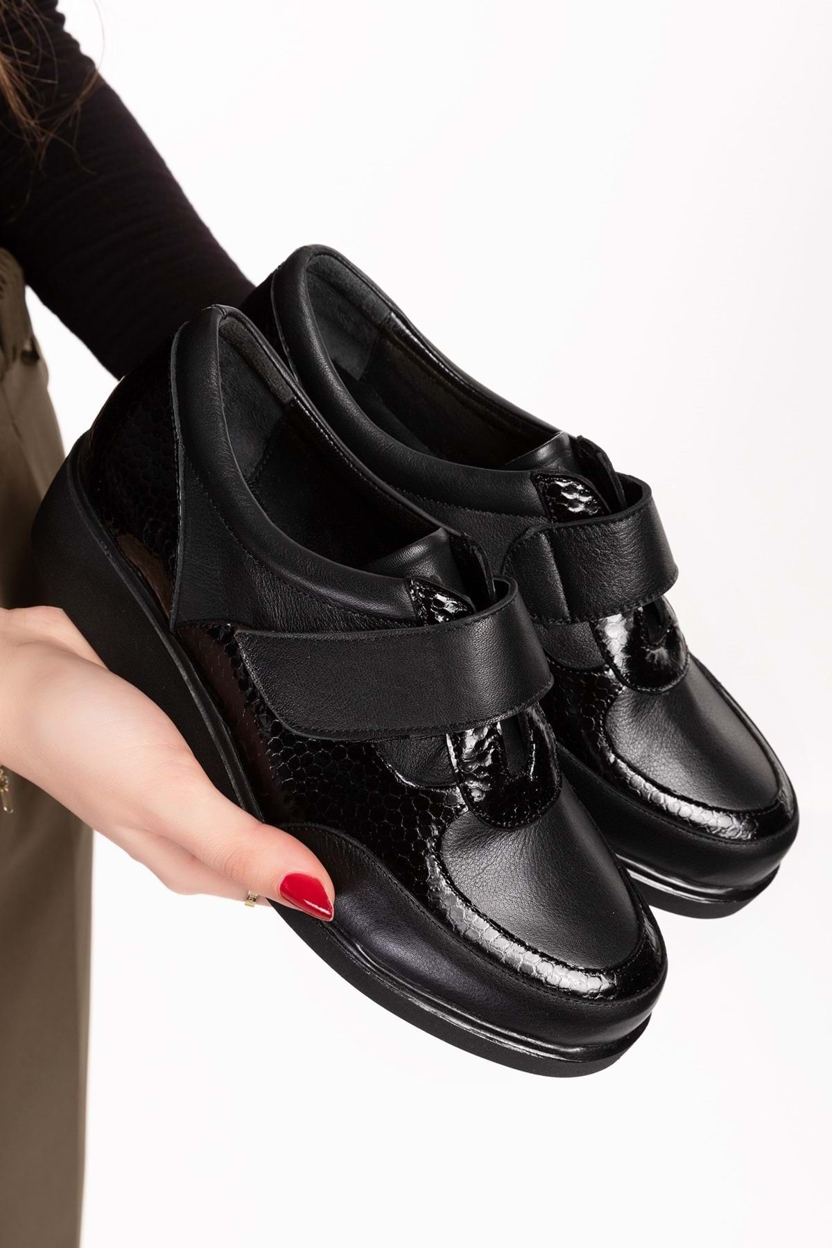 Gondol Hakiki Deri Anatomik Taban Cırtlı Kolay Giyim Ayakkabı tre.845 - Siyah - 38