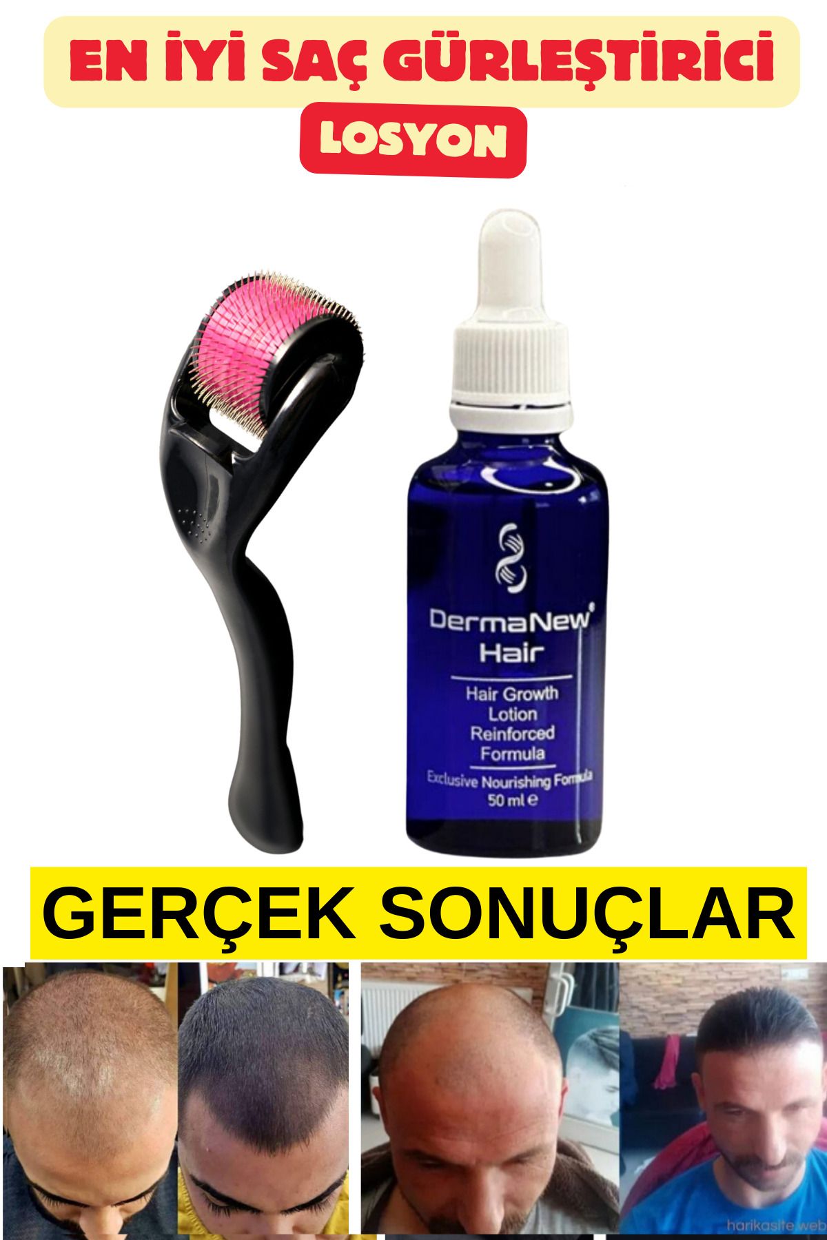 dermanew hair sac bakim seti - sac bakimi sac serum ve yagi - sac / 1 Adet+Roller