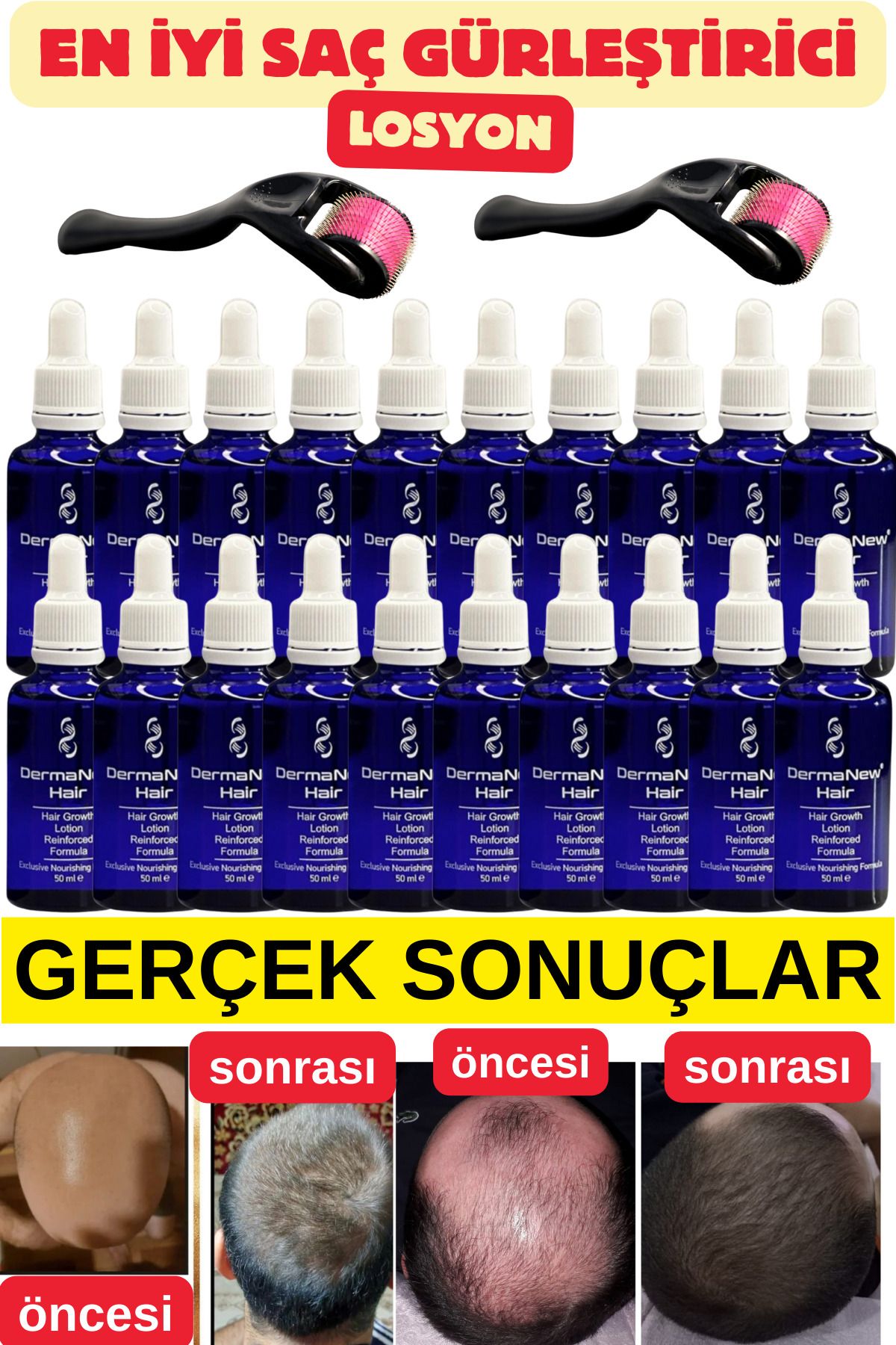 dermanew hair sac bakim seti -sac serumu / 20 Adet + 2 Roller