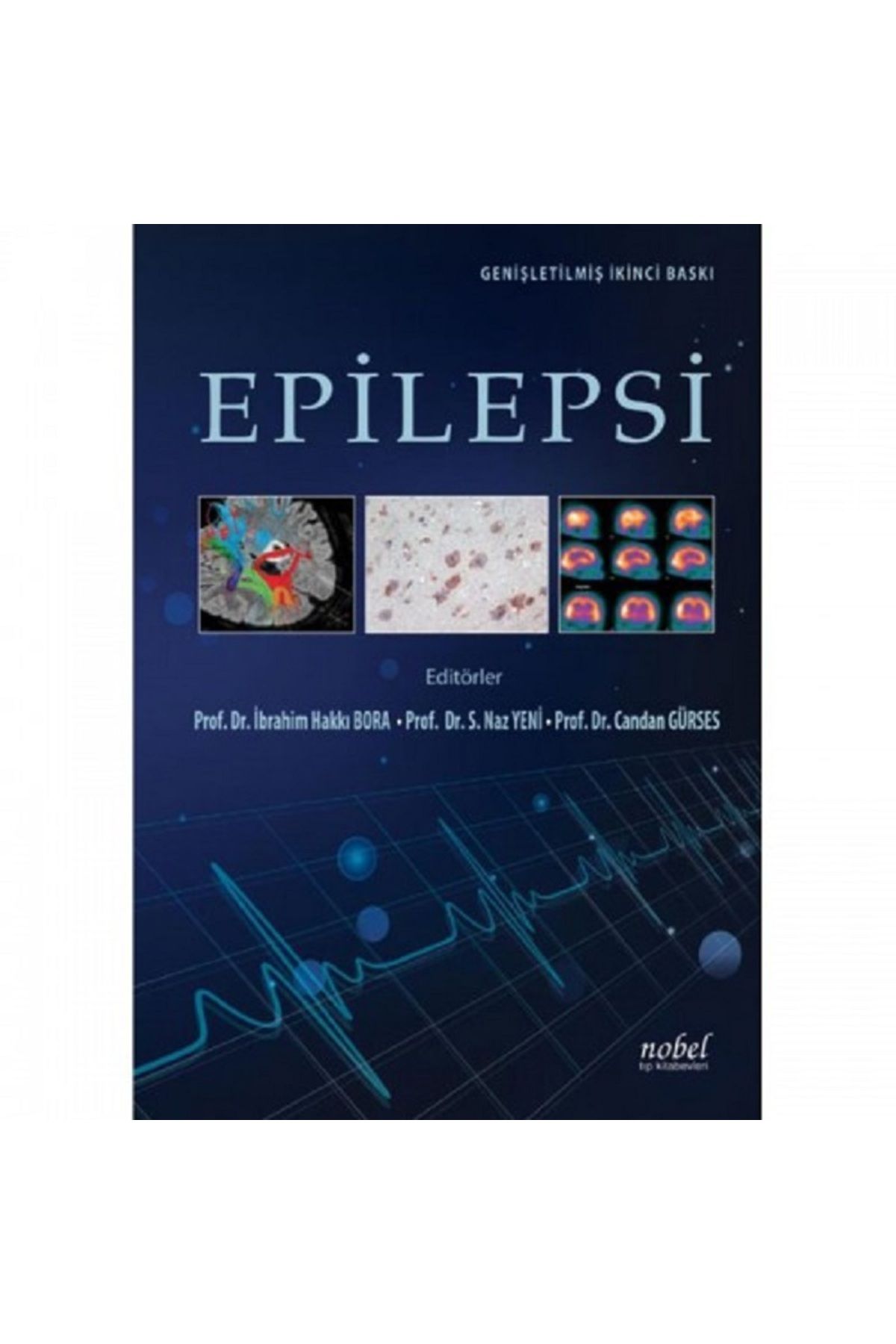 Nobel Epilepsi Genişletilmiş İkinci Baskı