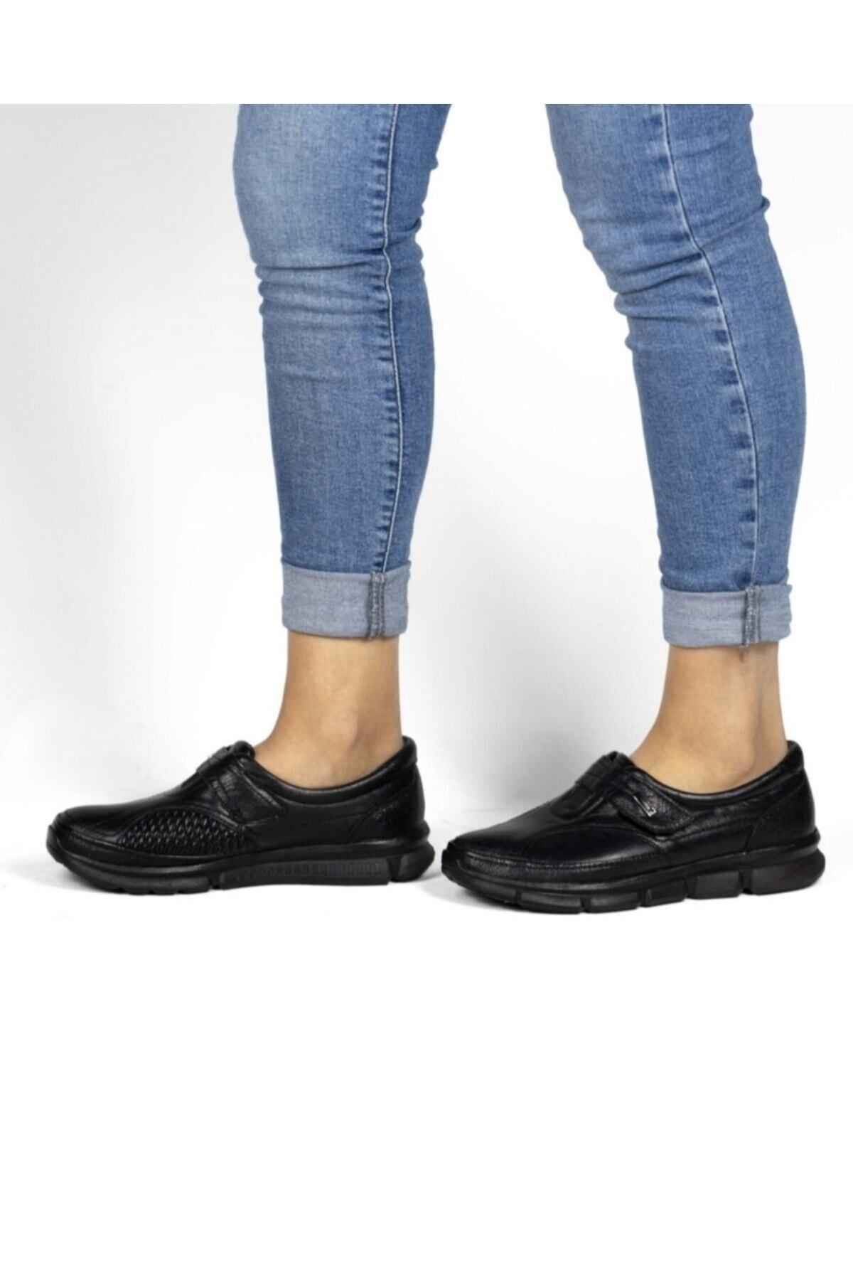 Belox Kadın Hakiki Deri Ortopedik Siyah Kemik Çıkıntısı Ayakkabısı