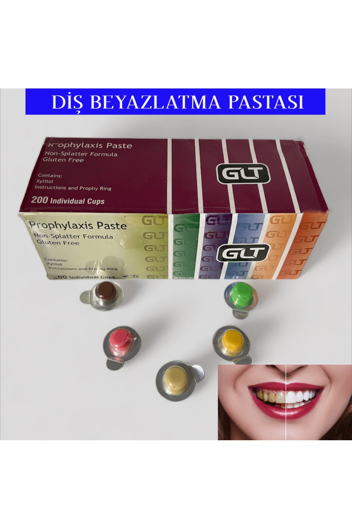 GLT Diş Beyazlatma Ve Temizleme Pastası / 5 Adet