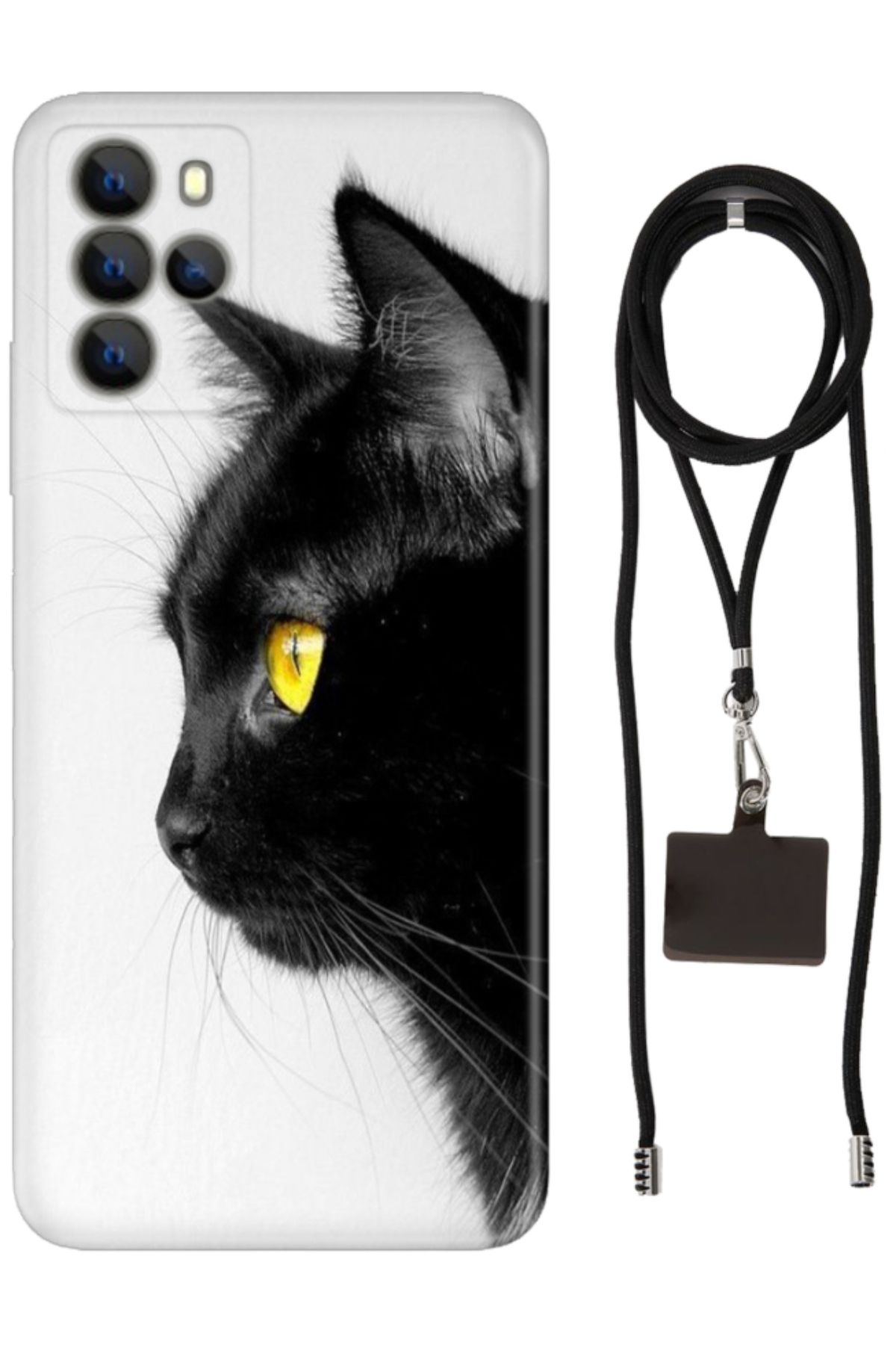 omix X700 Uyumlu Kılıf Boyun Askılı Telefon Askısı ve Desenli Silikon Kedi Bakışı