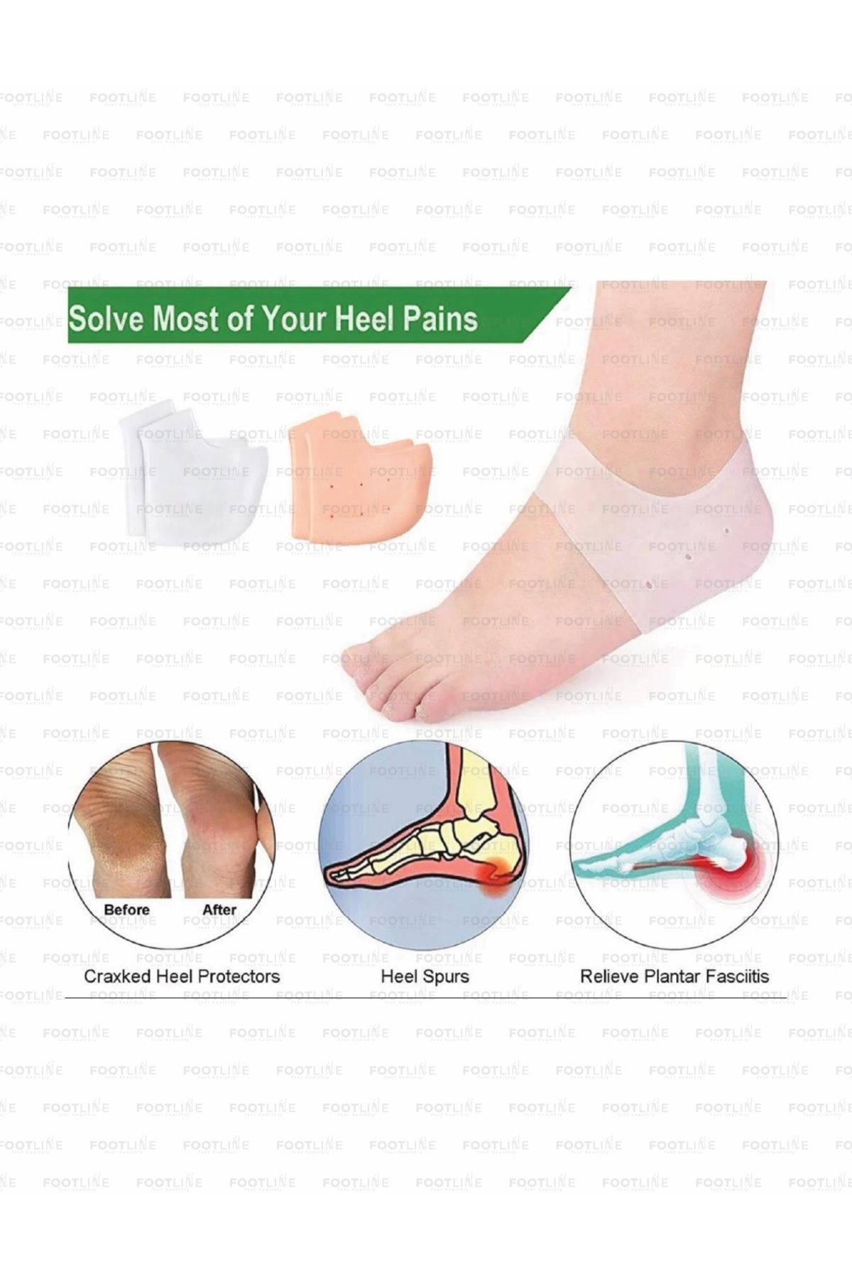 footlıne foot healthly Ortopedik Silikon Topuk Dikeni Gömleği, Çorabı, Çatlak Koruyucu Topukluk (1 Çift)