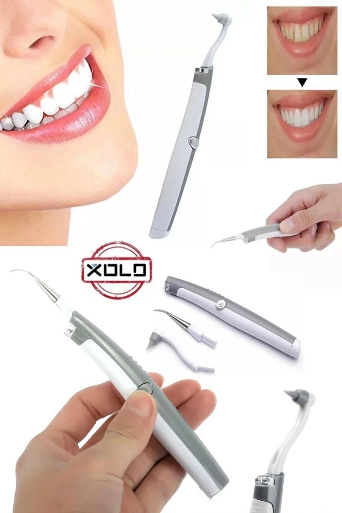 Xolo 2 in 1 Diş Leke Artık Tartar Temizleyici Ve Beyazlatma Cila Başlıklı Pilli Diş Bakım Kalemi Aleti