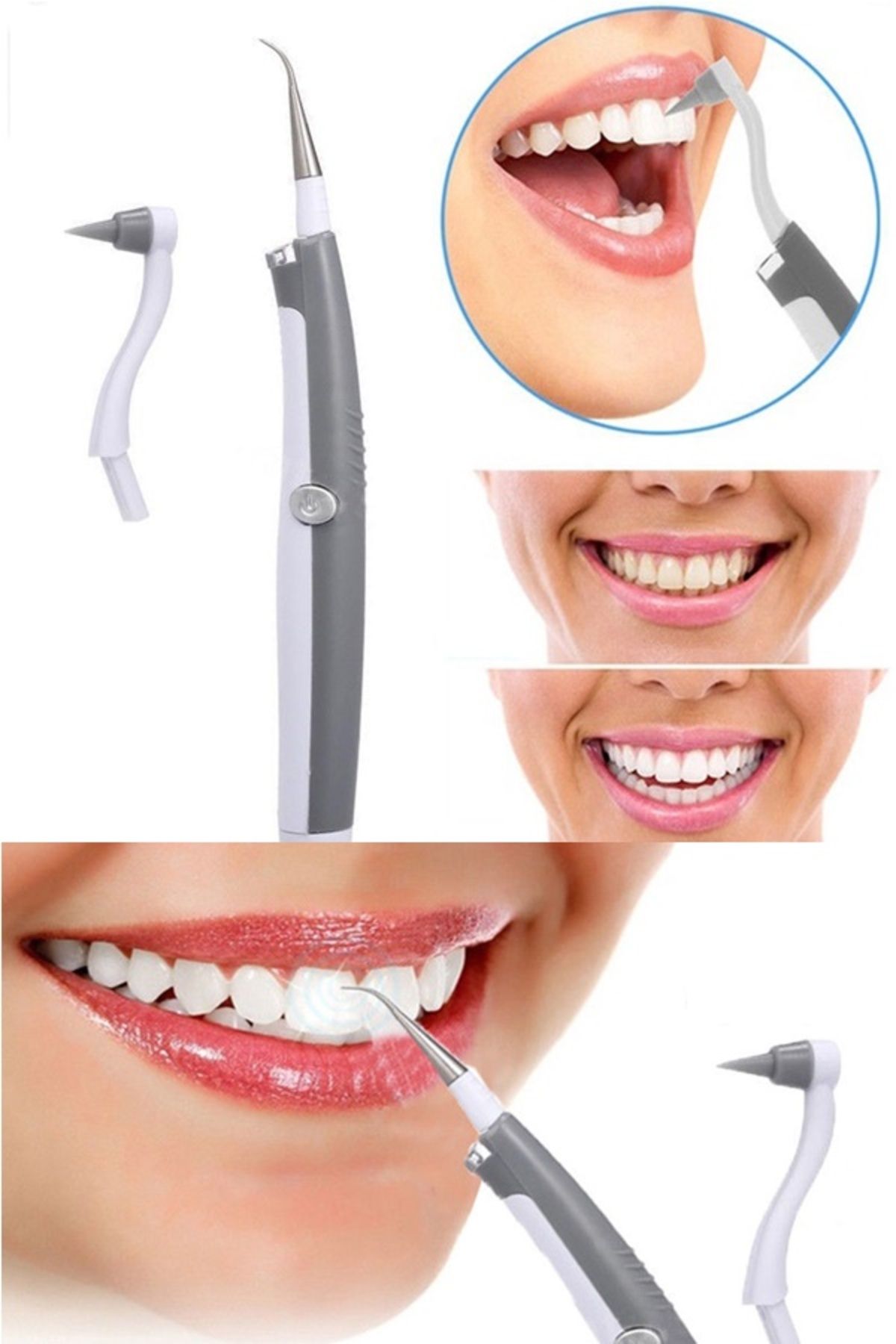 Xolo Beyazlatıcı ve Diş Silgisi 2li Diş Beyazlatma Bakım Seti Hello Xsonic