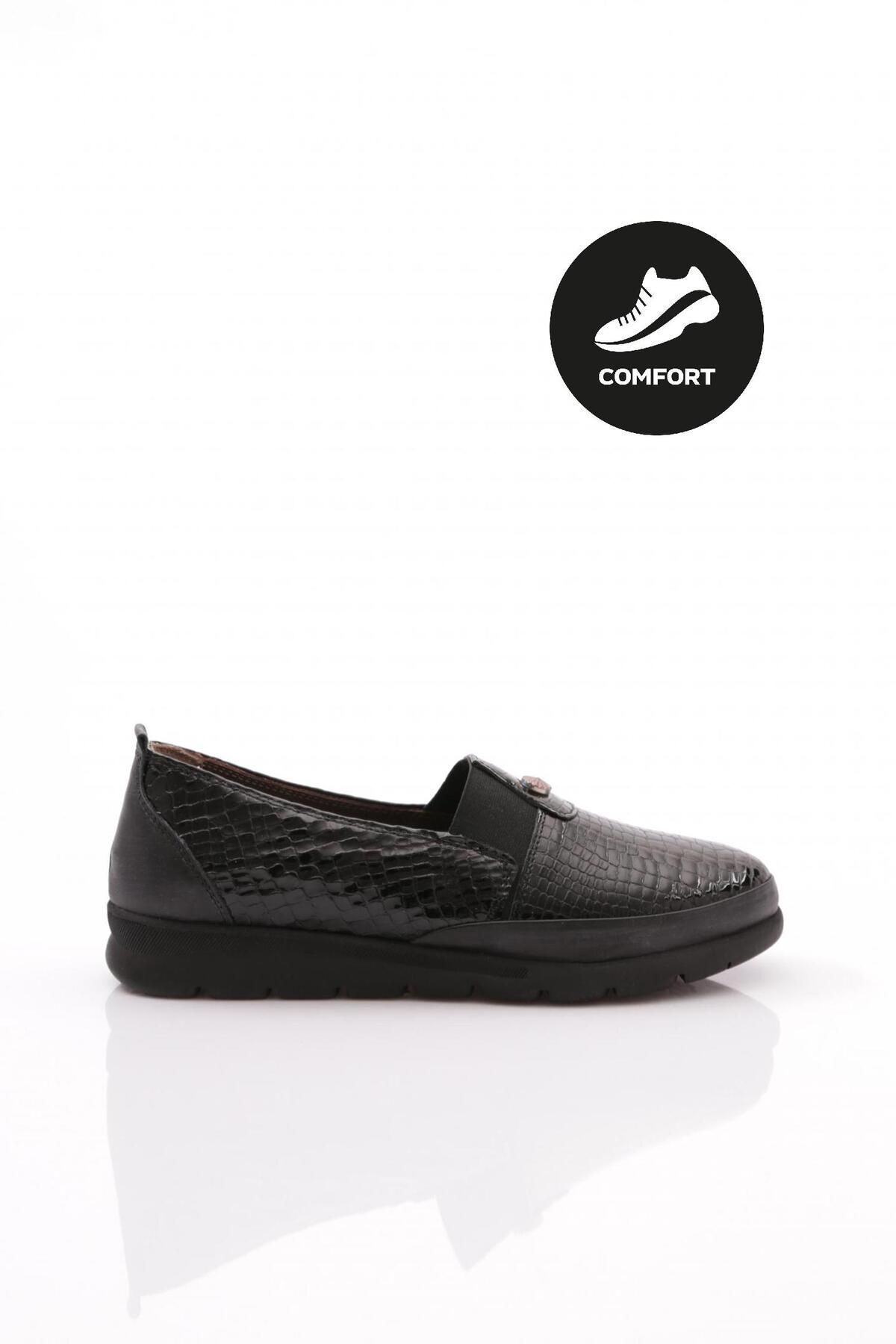Dgn 742-23y Kadın Lastik Detaylı Comfort Ayakkabı Hakiki Deri Siyah Kroko Rugan