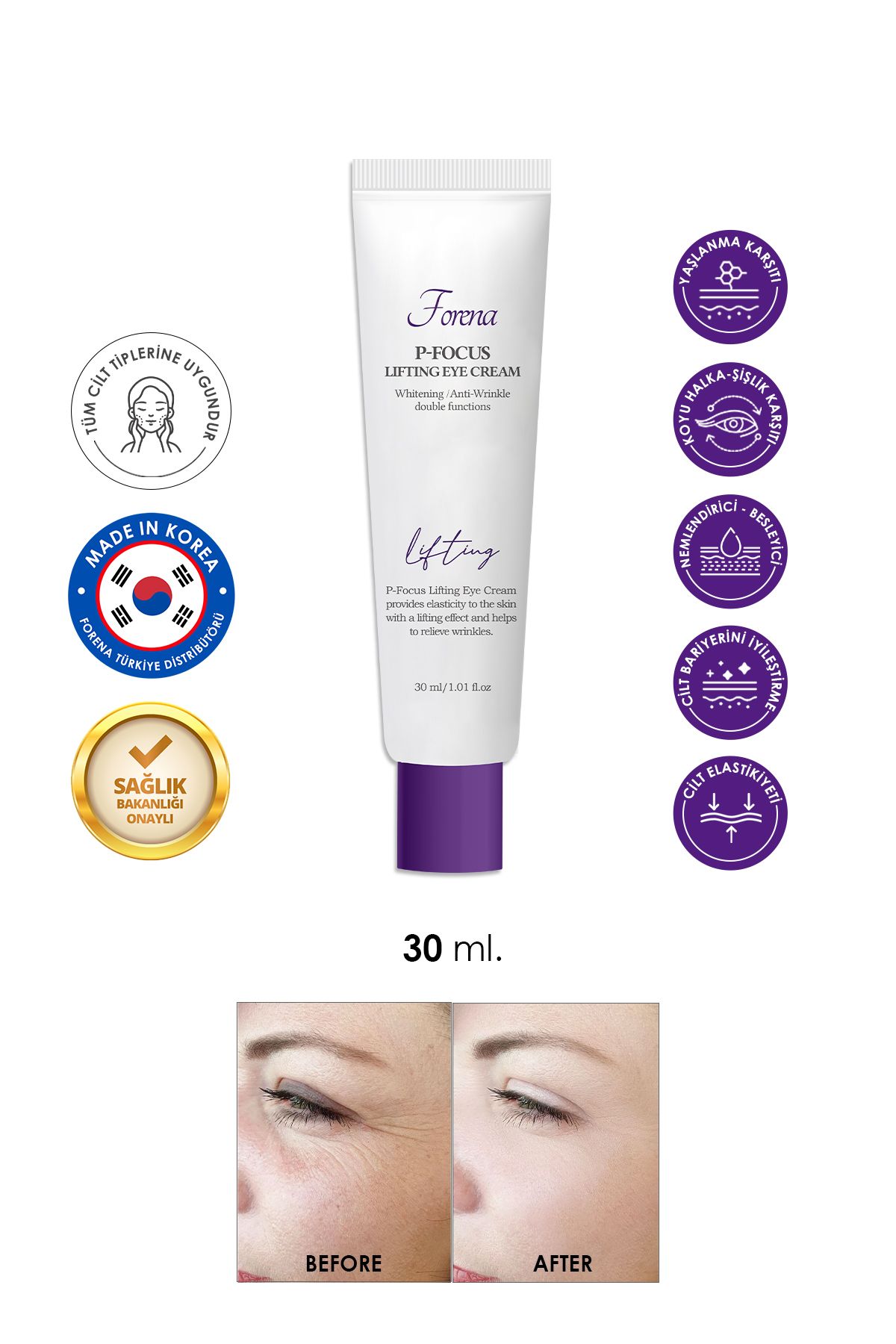 FORENA Kırışıklık Ve Göz Altı Morluklarına Karşı Göz Kremi – Yoğun Bakım & Canlandırıcı formül – 30ml
