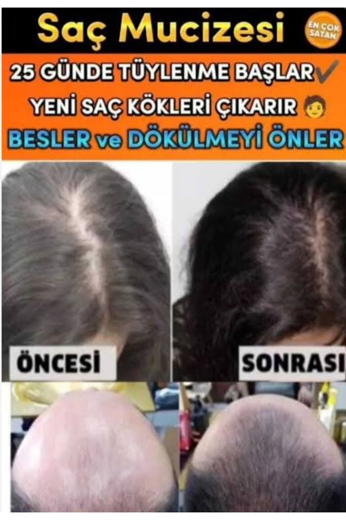 mavi serum Saç Serumu Saç Besleyici Saç Gürleştirici Saç Çıkaran Losyon 1adet