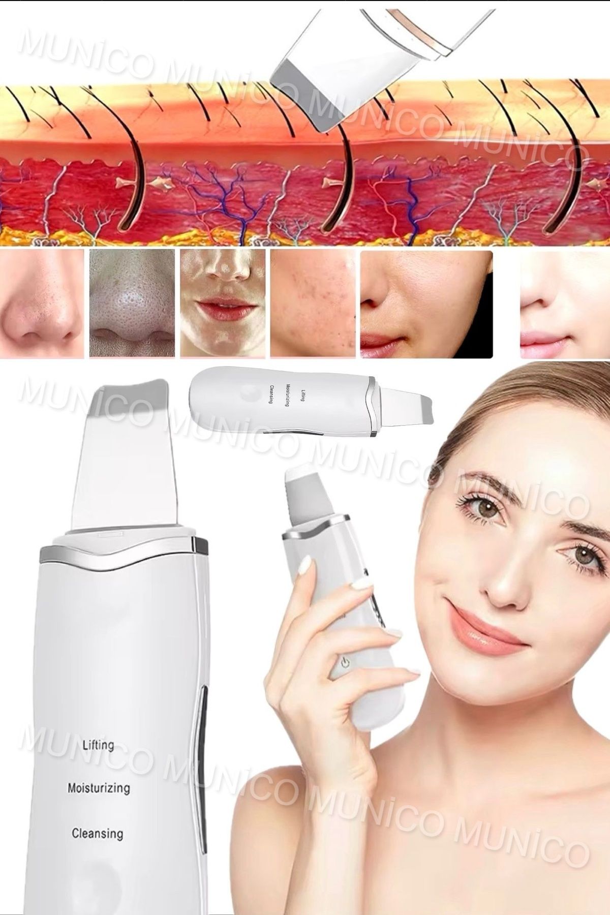 Genel Markalar Ultrasonik Yüz Temizleyici - Akne Giderme Cihazı, Peeling Spatula Beyaz Derinlemesine Temizlik İçin