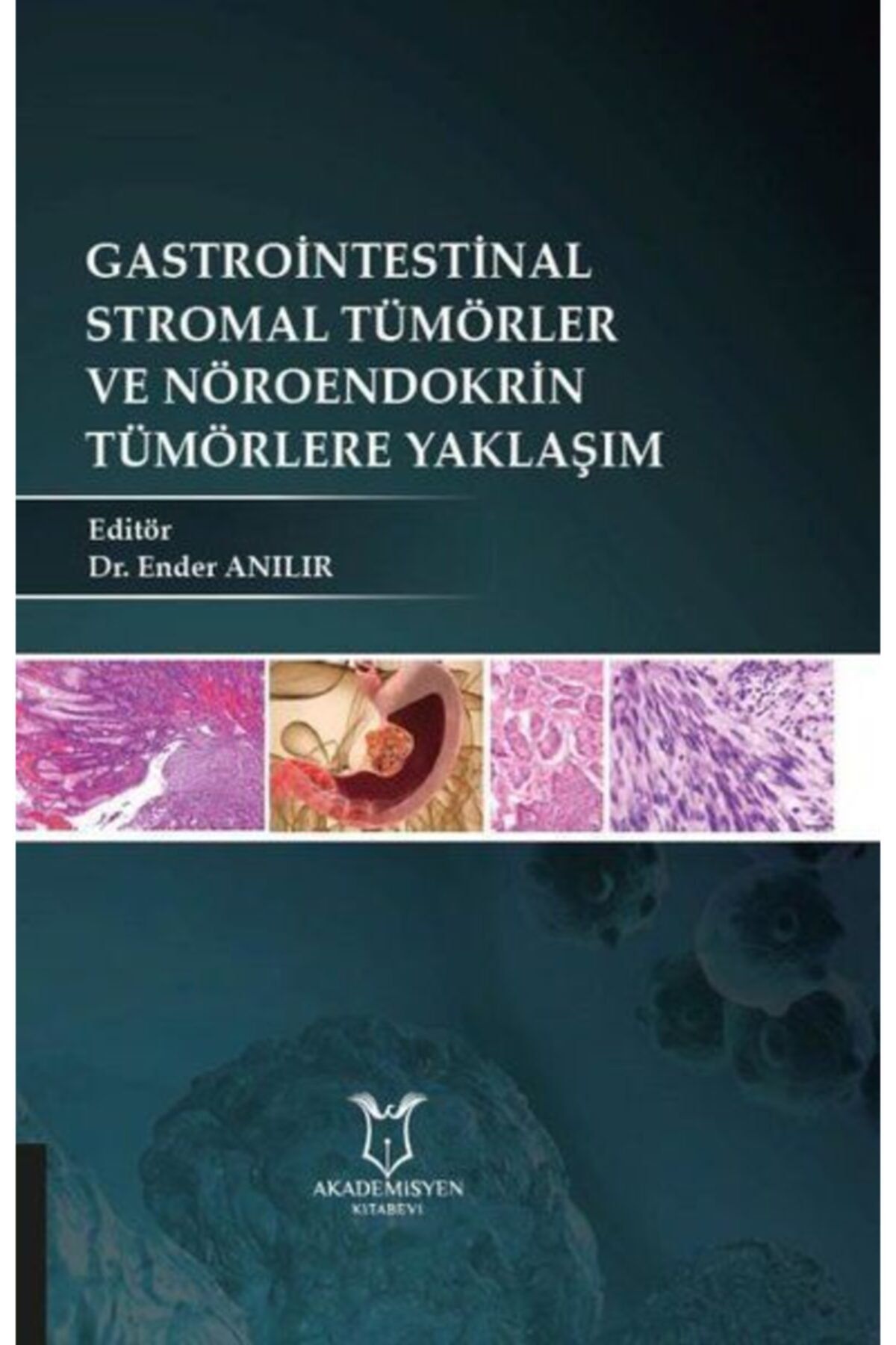Dünya Tıp Kitabevi Gastrointestinal Stromal Tümörler Ve Nöroendokrin Tümörlere Yaklaşım