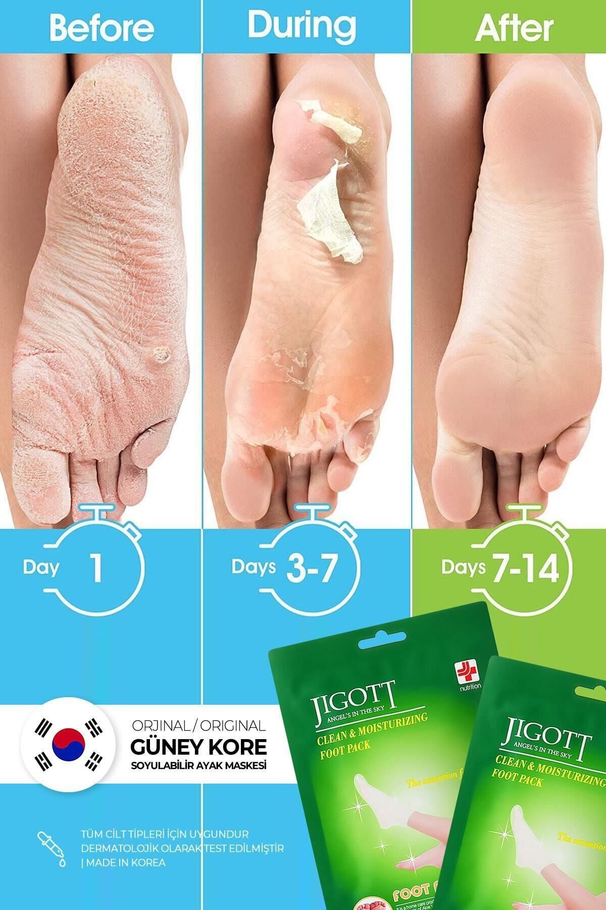 Jigott Çorap Tipi Soyulan Ayak Peeling Maskesi - Miracle Foot Peeling Pack