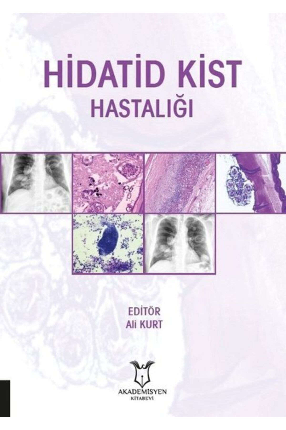 Akademisyen Kitabevi Hidatid Kist Hastalığı - Ali Kurt 9786257795289