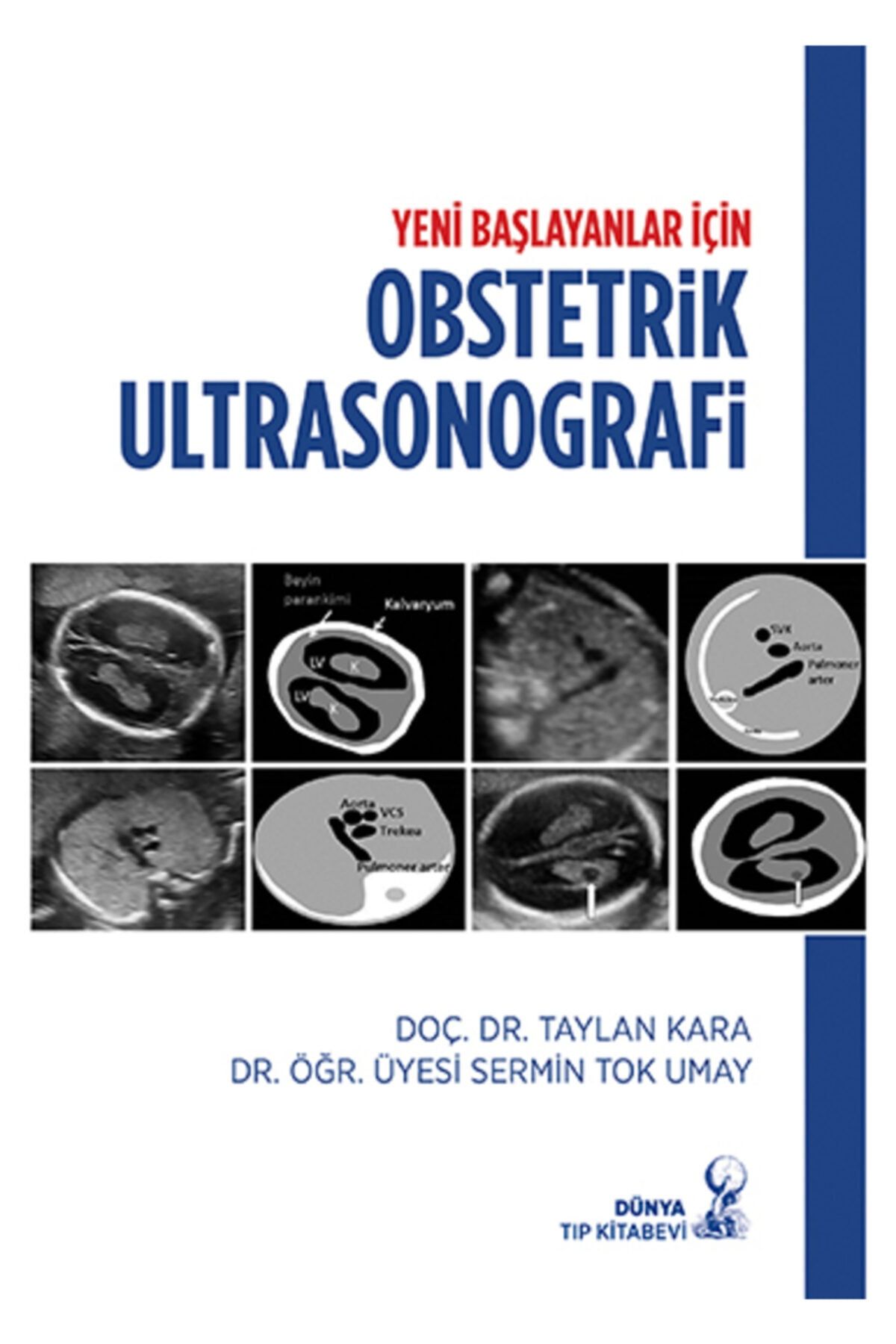 Dünya Tıp Kitabevi Yeni Başlayanlar Için Obstetrik Ultrasonografi