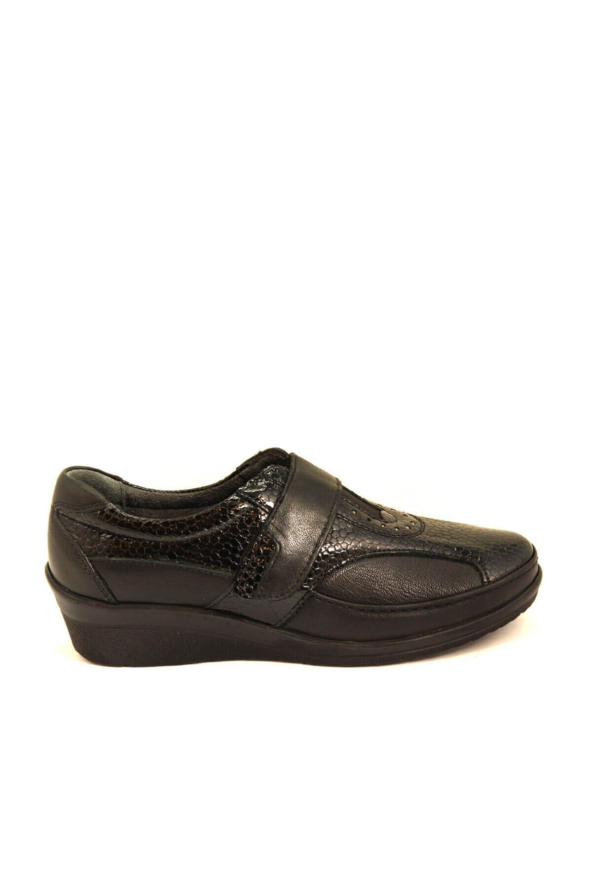 Forelli Kadın Siyah Deri Kemik Çıkıntısına Özel Comfort Ayakkabı