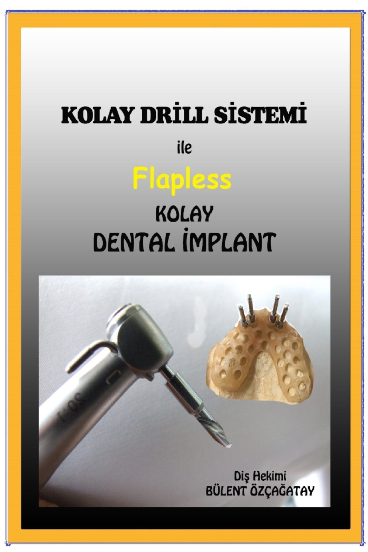 ÖzçağatayYayıncılık Kolay Drill Sistemi Ile Flapless Kolay Implant
