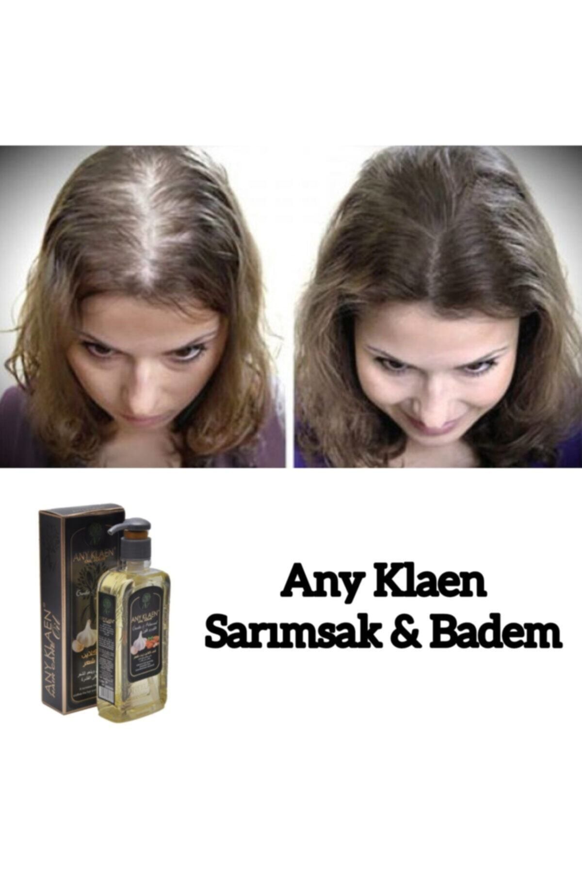Any Klaen Hair Oil- Badem Ve Sarımsak Özlü
