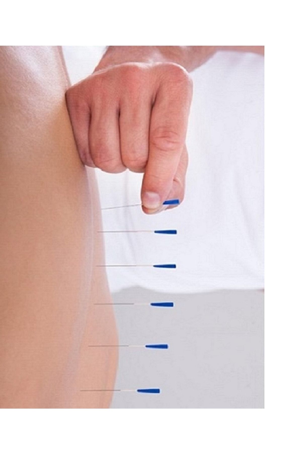 Ramak Maxi Air Akupunktur Iğnesi Kuru Iğne Needle 0.25x25 Mm Grup Ürünü