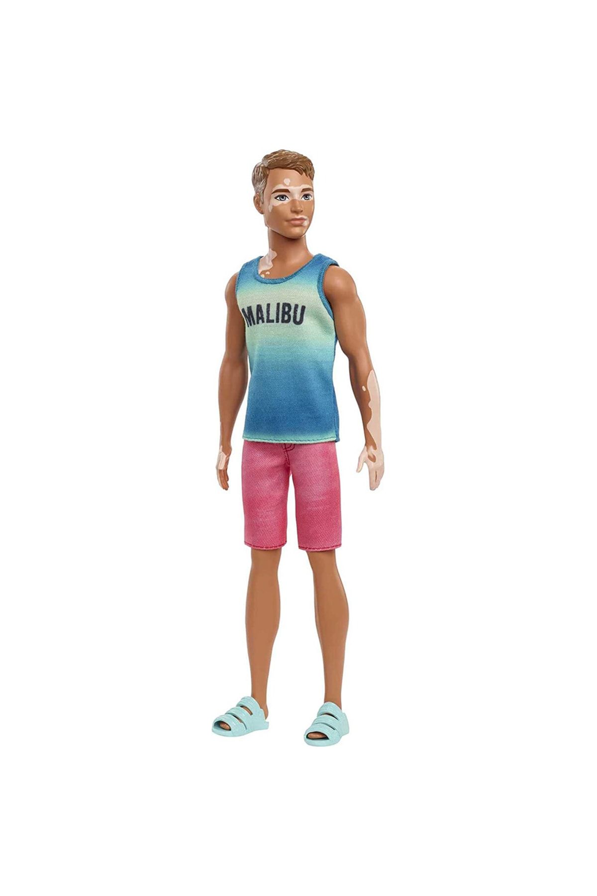Barbie Yakışıklı Ken Bebek Vitiligo Oyuncak Erkek Model Bebek