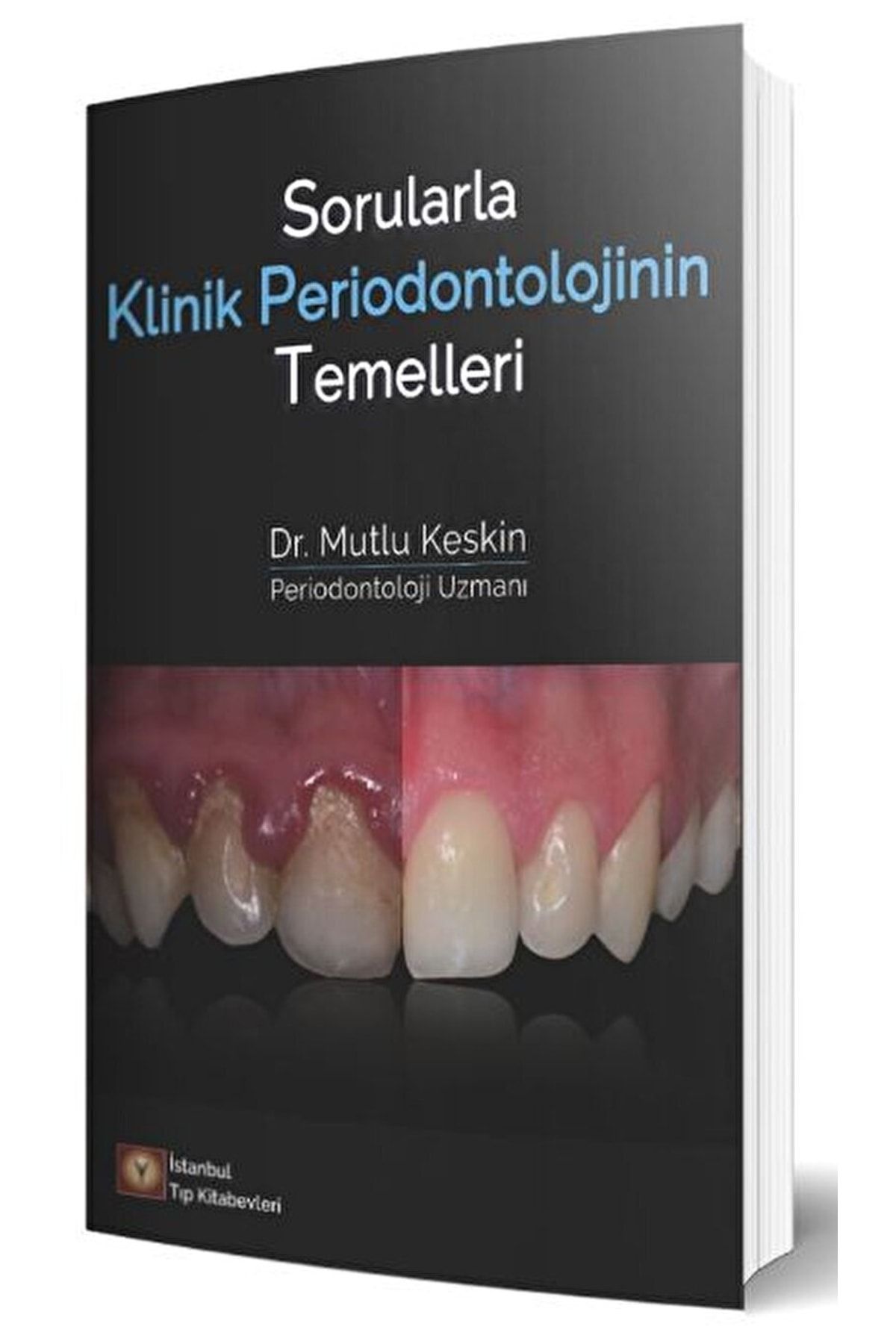 İstanbul Tıp Kitabevi Sorularla Klinik Periodontolojinin Temelleri / Mutlu Keskin / / 9786257291989