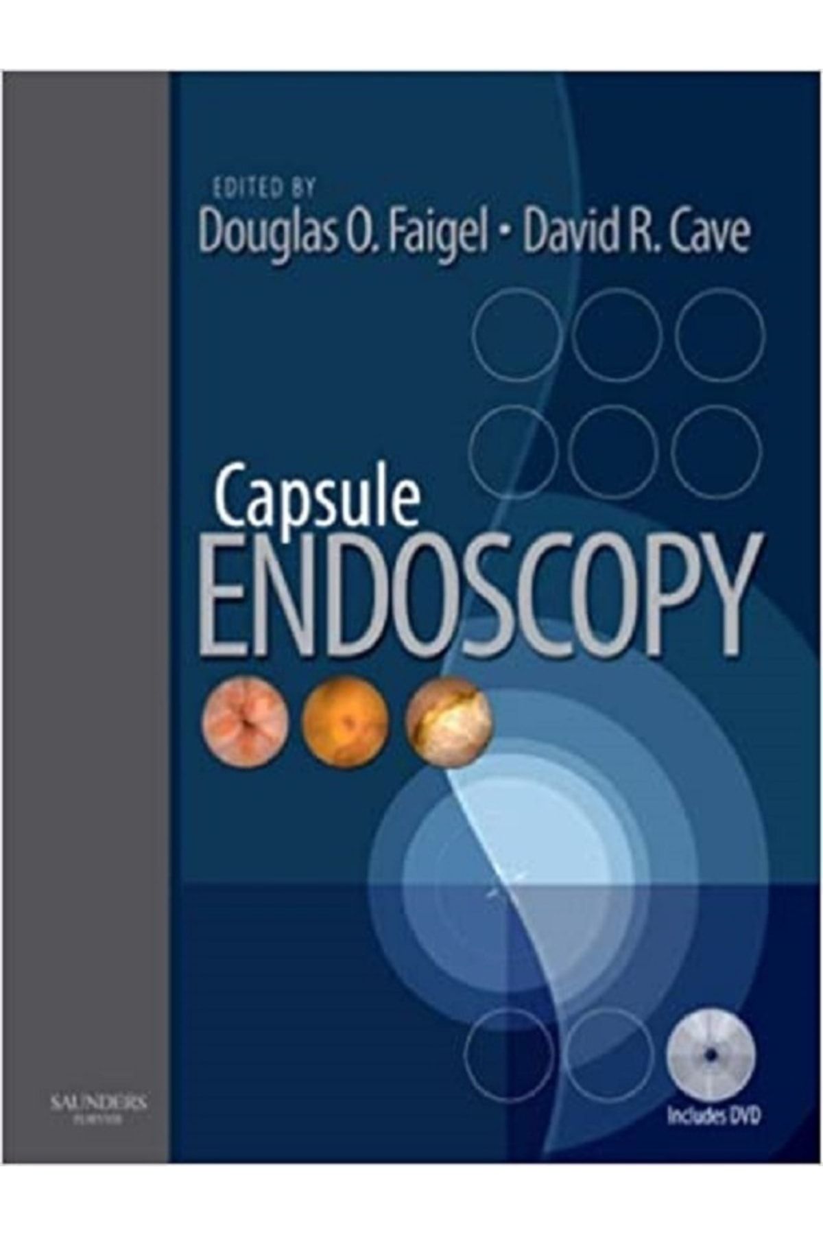 Capsule Endoscopy: Text With Dvd 1st Edition_0