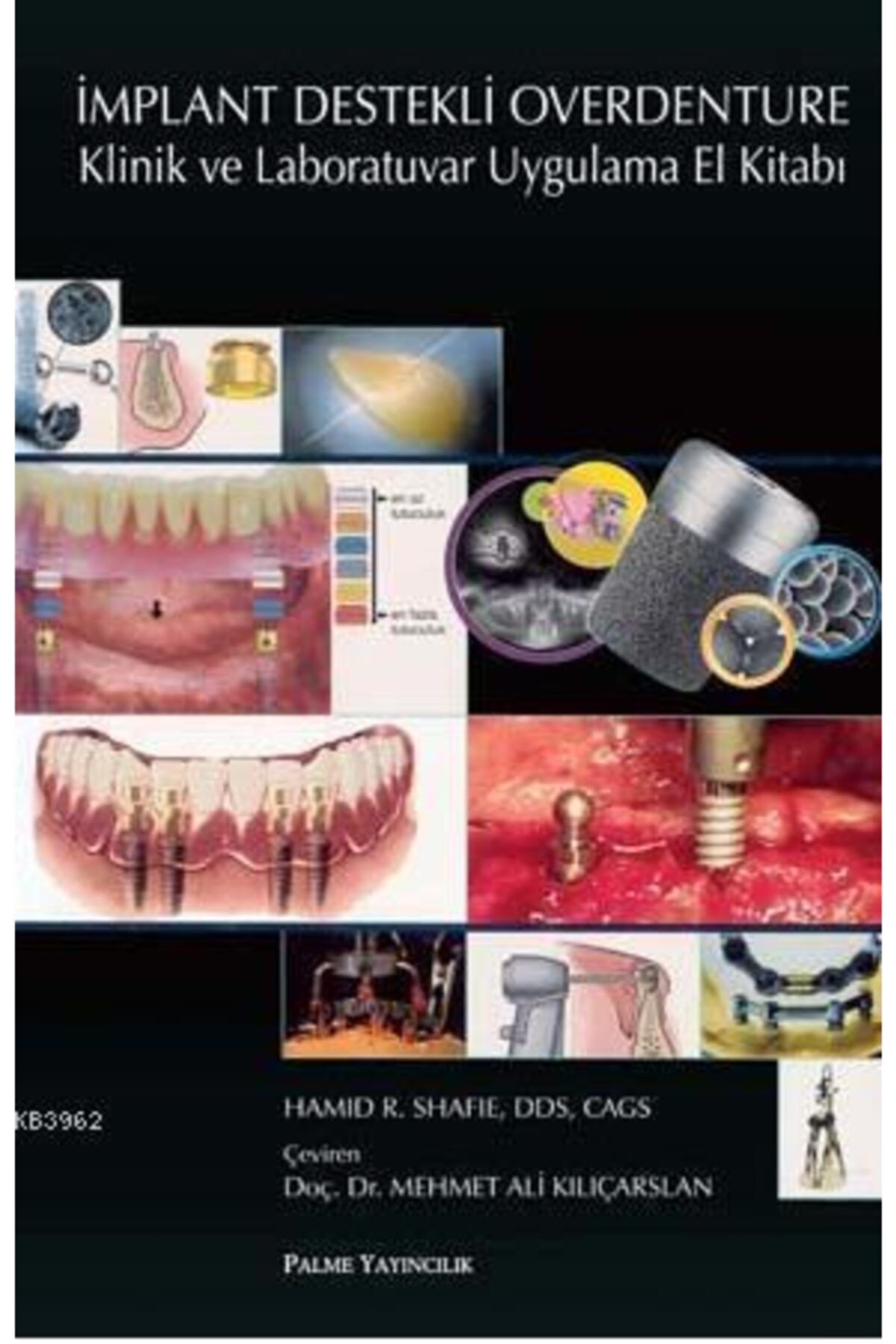 Palme Yayınevi Implant Destekli Overdenture Klinik Ve Laboratuvar Uygulama El Kitabı
