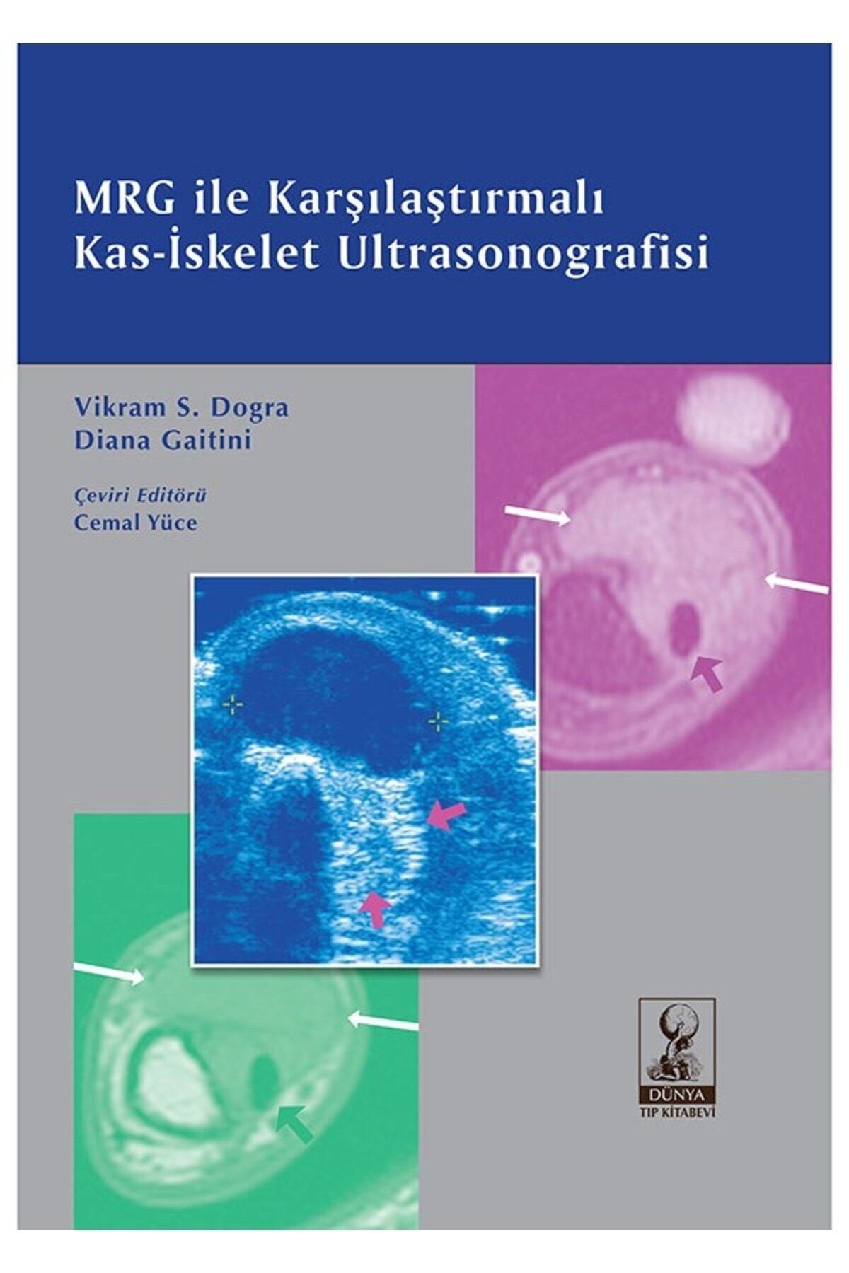 Dünya Tıp Kitabevi MRG ile Karşılaştırmalı Kas-İskelet Ultrasonografisi