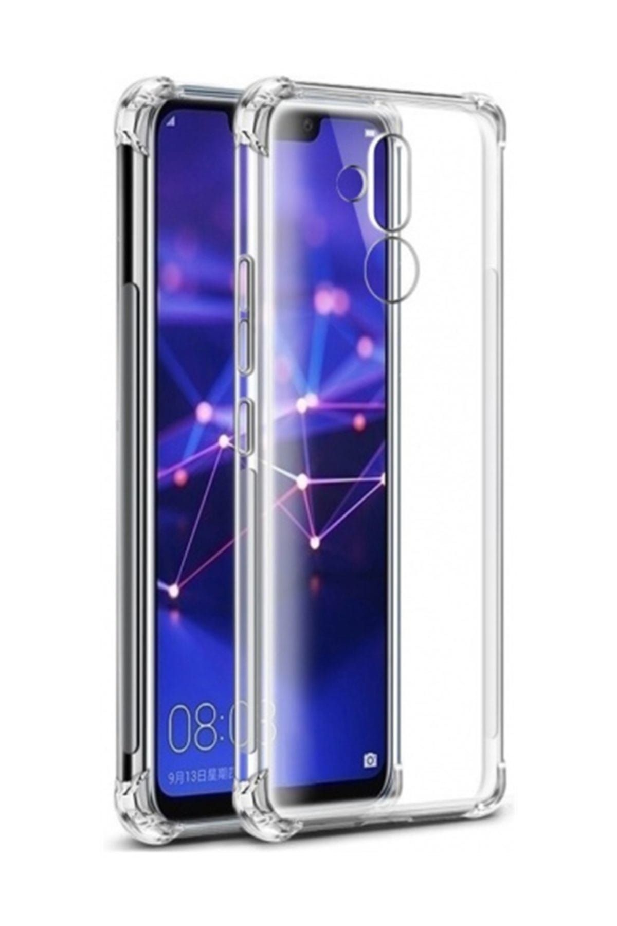 Telefon Aksesuarları Zengin Çarşım Huawei Mate 20 Lite Kılıf Ultra İnce Şeffaf Airbag  Silikon - Ve Ekran Koruyucu