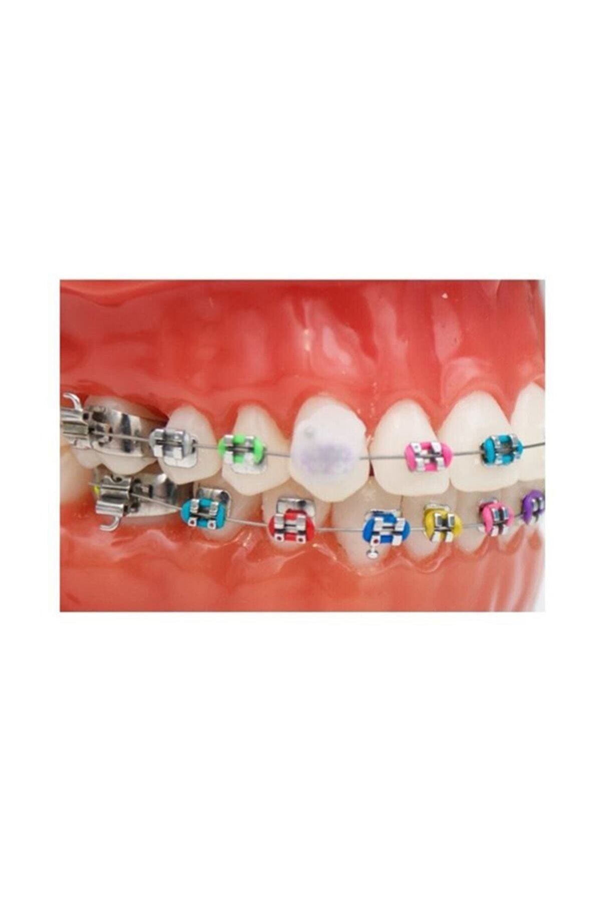 GC Dentalsepet Ortodonti Mumu Diş Teli Mumu Ortodontik Wax