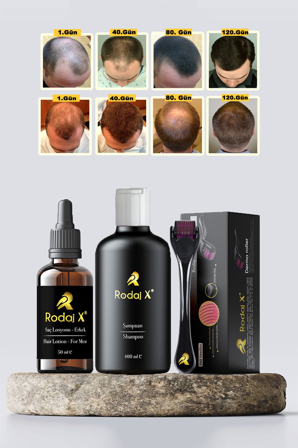 Rodaj X Erkek Saç Çıkarmaya Yardımcı Serum - Dökülme Önleyici Şampuan - Dermaroller