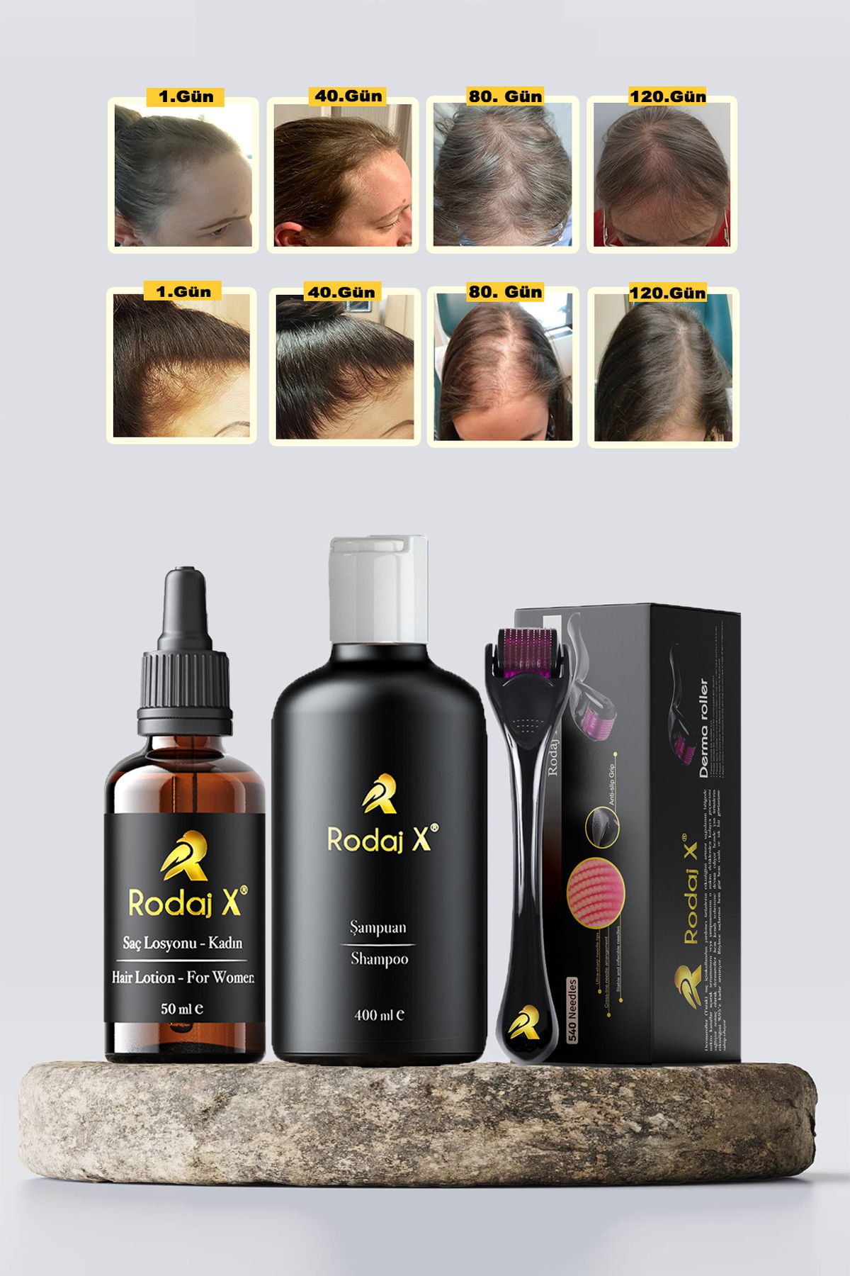 Rodaj X Kadın Saç Çıkarmaya Yardımcı Serum - Dökülme Karşıtı Şampuan - Dermaroller