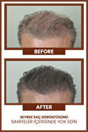 پودر حجم دهنده مو فیبر قهوه ای | کانسیلر موهای نازک و حجم دهنده طبیعی-thumb