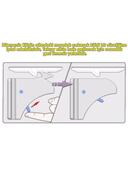 - کابینت مغناطیسی مخفی/قفل کشو - 4 قفل-thumb