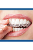 دستگاه ترموفرم صفحه شب سیلیکونی محافظ دهان-thumb