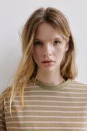 No feature was seen on the skin.