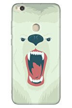 Cekuonline P9 Lite 2017 Kılıf Colored Desenli Silikon Bear Fight - 1