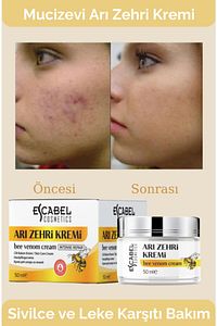 Yüz Kremi - Arı zehiri Siyah Nokta ve Sivilce Akne Karşıtı Leke Temizleyici Yüz Kremi 50 ml