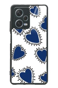 Related product image Spoyi Phone Case
