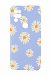Related product image omix Phone Case