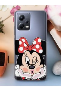 Related product image Spoyi Phone Case