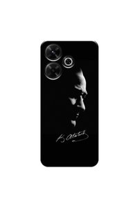 Related product image Zebana Phone Case