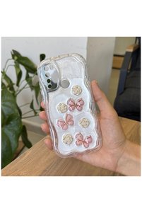 Related product image Zebana Phone Case