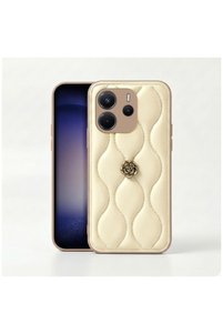 Related product image Zebana Phone Case